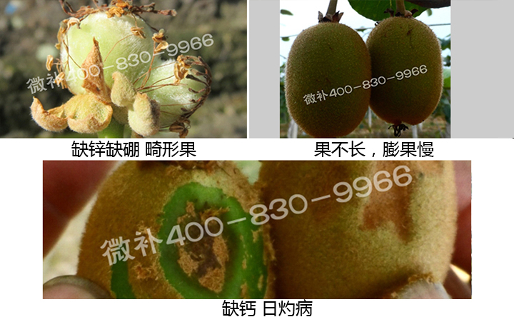 微補(bǔ) 微補(bǔ)